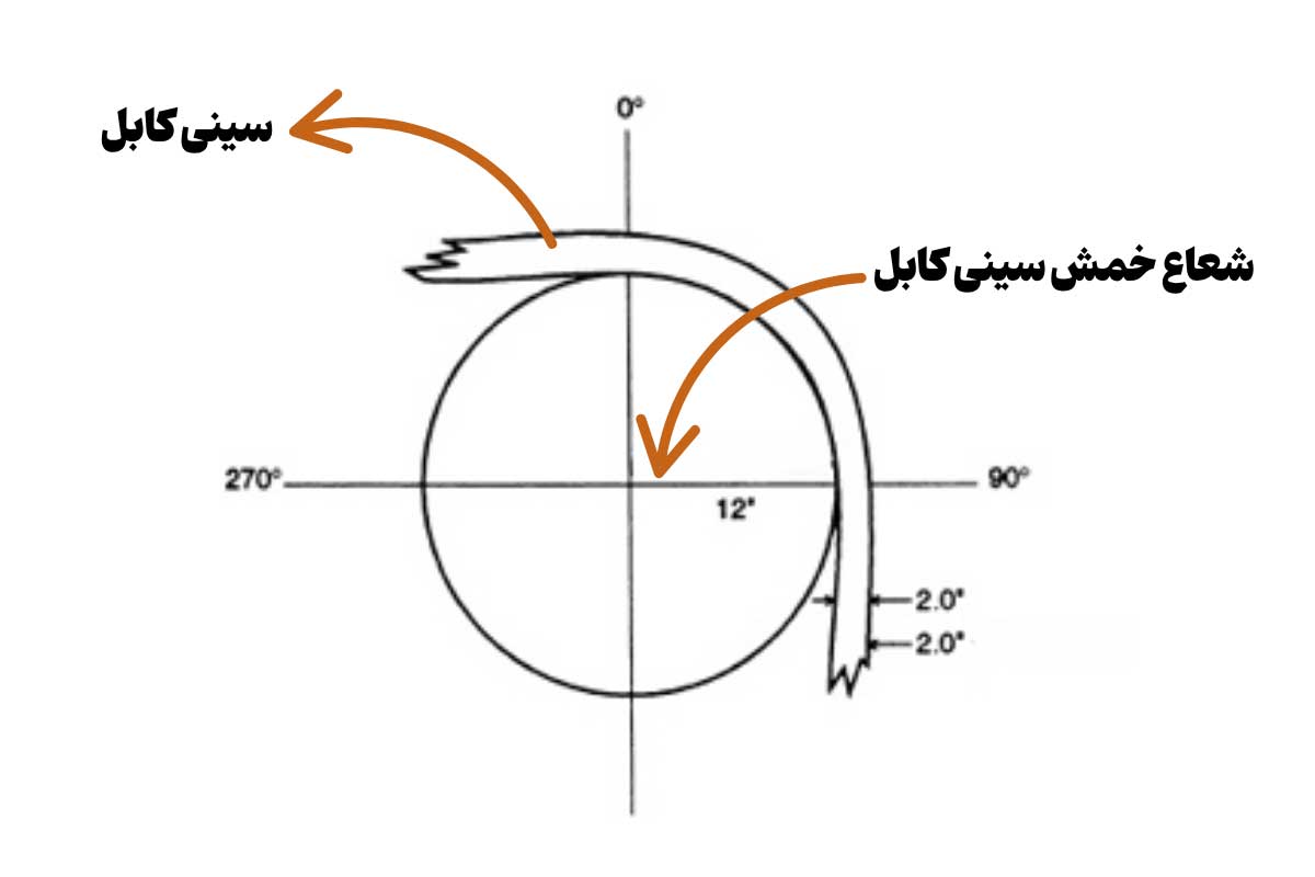 شعاع خمش سینی کابل